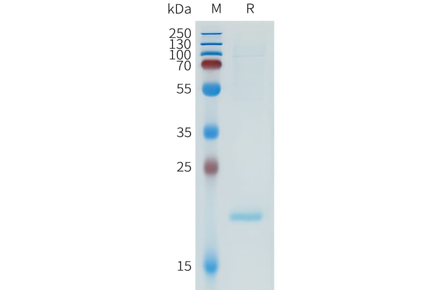 SDS-PAGE - Recombinant Human ApoA1 Protein (N-terminal 6xHis Tag) (A332951) - Antibodies.com