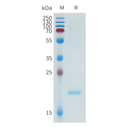 SDS-PAGE - Recombinant Human ApoA1 Protein (N-terminal 6xHis Tag) (A332951) - Antibodies.com