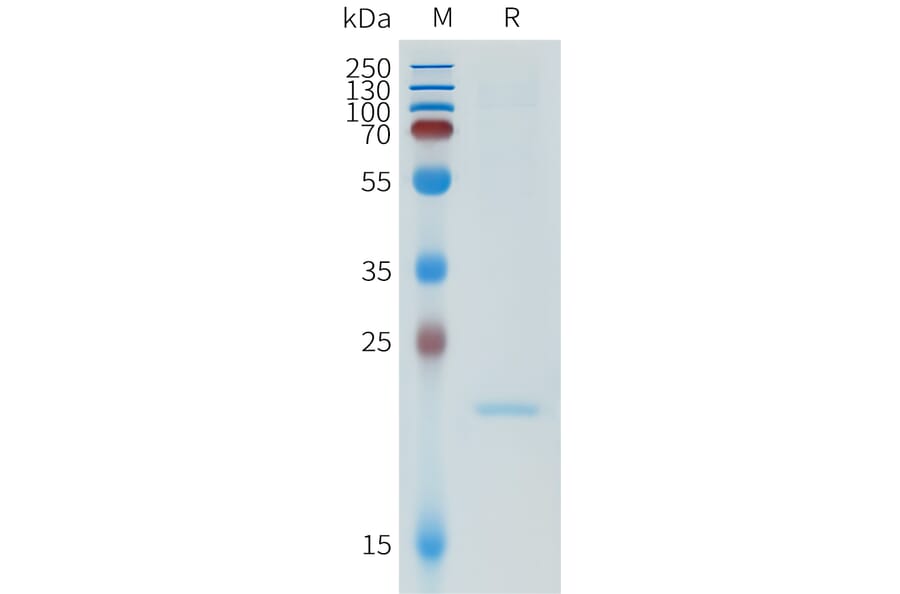 SDS-PAGE - Recombinant Human ApoA1 Protein (N-terminal 6xHis Tag) (A332952) - Antibodies.com
