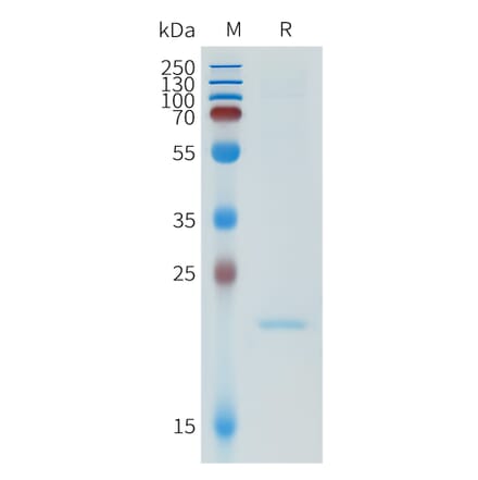 SDS-PAGE - Recombinant Human ApoA1 Protein (N-terminal 6xHis Tag) (A332952) - Antibodies.com
