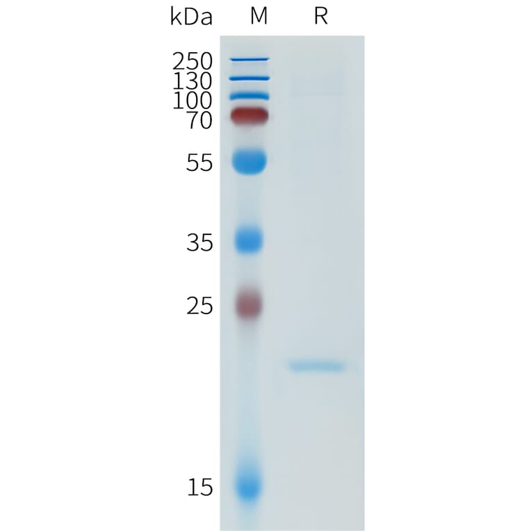 SDS-PAGE - Recombinant Human ApoA1 Protein (N-terminal 6xHis Tag) (A332952) - Antibodies.com