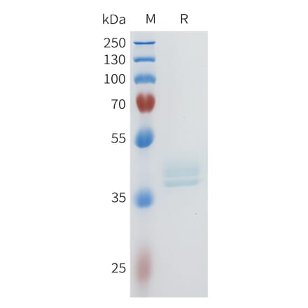 SDS-PAGE - Recombinant Human c-Kit Protein (C-terminal hFc Tag) (A332954) - Antibodies.com