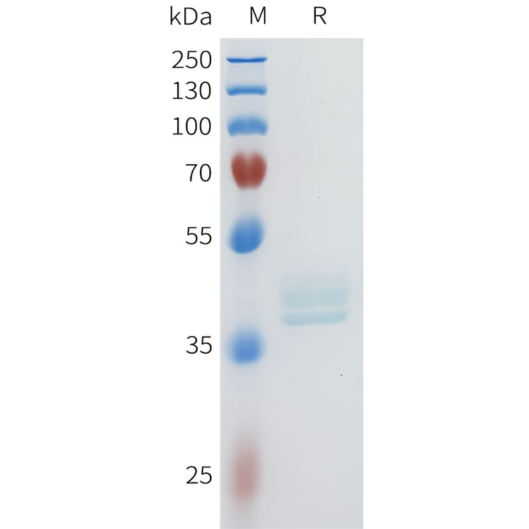 SDS-PAGE - Recombinant Human c-Kit Protein (C-terminal hFc Tag) (A332954) - Antibodies.com