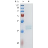 SDS-PAGE - Recombinant Human c-Kit Protein (C-terminal hFc Tag) (A332954) - Antibodies.com