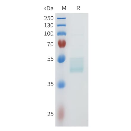 SDS-PAGE - Recombinant Human c-Kit Protein (C-terminal hFc Tag) (A332955) - Antibodies.com