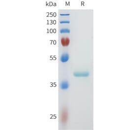 SDS-PAGE - Recombinant Human PVRL4 Protein (C-terminal hFc Tag) (A332956) - Antibodies.com