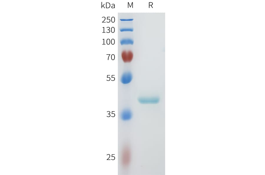 SDS-PAGE - Recombinant Human PVRL4 Protein (C-terminal hFc Tag) (A332956) - Antibodies.com