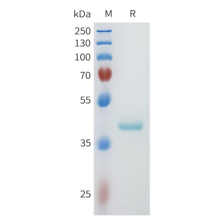 SDS-PAGE - Recombinant Human PVRL4 Protein (C-terminal hFc Tag) (A332956) - Antibodies.com