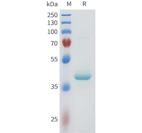 SDS-PAGE - Recombinant Human PVRL4 Protein (C-terminal hFc Tag) (A332957) - Antibodies.com