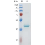 SDS-PAGE - Recombinant Human PVRL4 Protein (C-terminal hFc Tag) (A332957) - Antibodies.com
