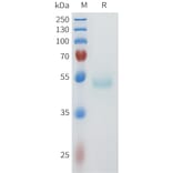 SDS-PAGE - Recombinant Human PVRL4 Protein (C-terminal hFc Tag) (A332958) - Antibodies.com