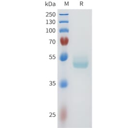 SDS-PAGE - Recombinant Human E Cadherin Protein (C-terminal hFc Tag) (A332959) - Antibodies.com