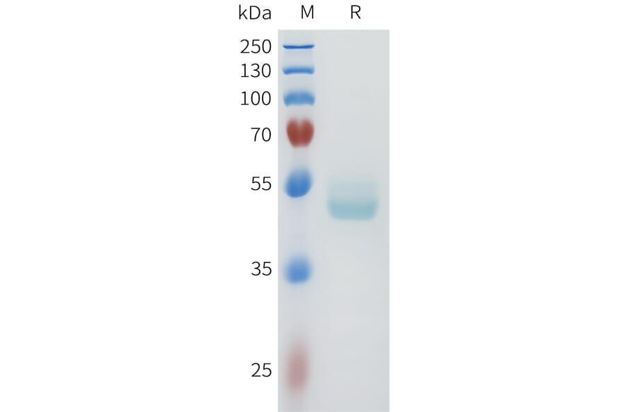 SDS-PAGE - Recombinant Human E Cadherin Protein (C-terminal hFc Tag) (A332959) - Antibodies.com