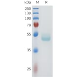 SDS-PAGE - Recombinant Human E Cadherin Protein (C-terminal hFc Tag) (A332959) - Antibodies.com