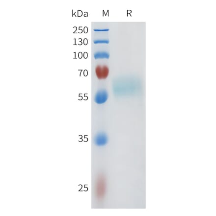 SDS-PAGE - Recombinant Human ACVR2A Protein (C-terminal mFc Tag) (A332961) - Antibodies.com