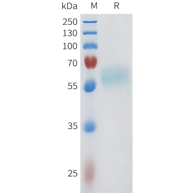 SDS-PAGE - Recombinant Human ACVR2A Protein (C-terminal mFc Tag) (A332961) - Antibodies.com