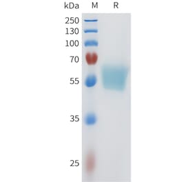 SDS-PAGE - Recombinant Human ACVR2B Protein (C-terminal mFc Tag) (A332962) - Antibodies.com
