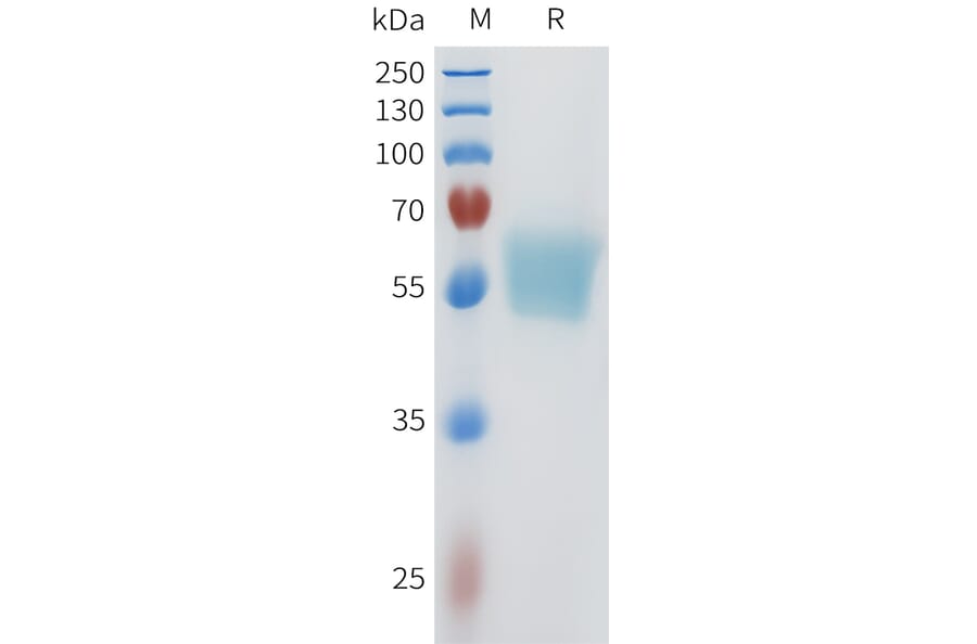 SDS-PAGE - Recombinant Human ACVR2B Protein (C-terminal mFc Tag) (A332962) - Antibodies.com