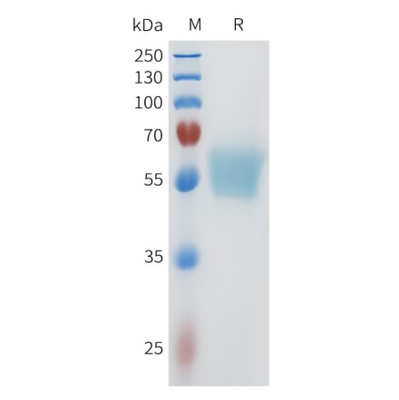 SDS-PAGE - Recombinant Human ACVR2B Protein (C-terminal mFc Tag) (A332962) - Antibodies.com