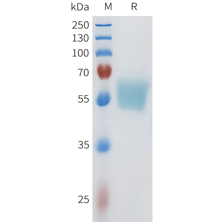 SDS-PAGE - Recombinant Human ACVR2B Protein (C-terminal mFc Tag) (A332962) - Antibodies.com