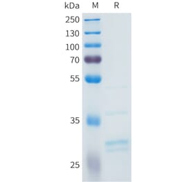 SDS-PAGE - Recombinant Human FGF2 Protein (C-terminal 3xFlag Tag) (A332964) - Antibodies.com