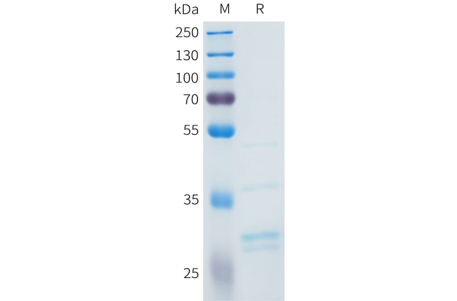 SDS-PAGE - Recombinant Human FGF2 Protein (C-terminal 3xFlag Tag) (A332964) - Antibodies.com