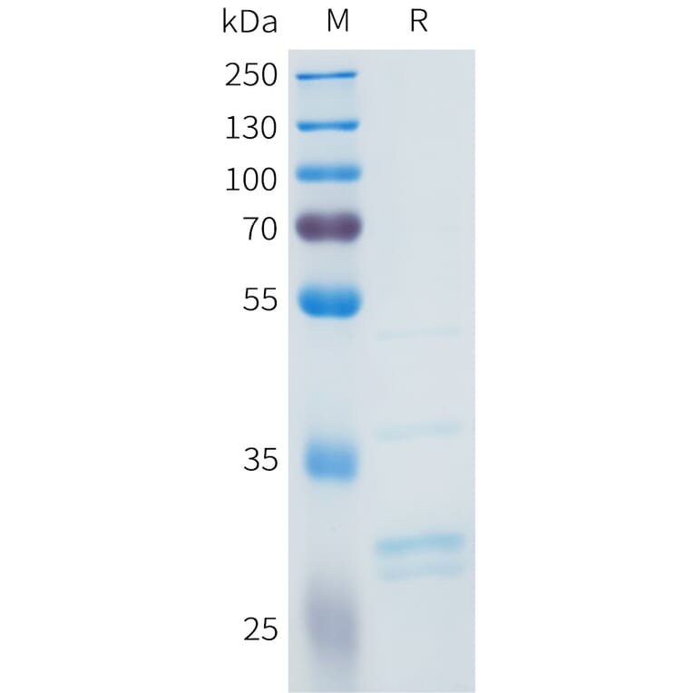 SDS-PAGE - Recombinant Human FGF2 Protein (C-terminal 3xFlag Tag) (A332964) - Antibodies.com