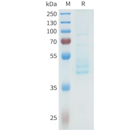 SDS-PAGE - Recombinant Human P-Cadherin Protein (C-terminal hFc Tag) (A332965) - Antibodies.com
