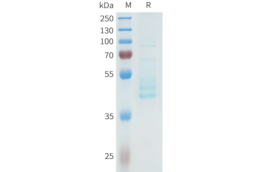 SDS-PAGE - Recombinant Human P-Cadherin Protein (C-terminal hFc Tag) (A332965) - Antibodies.com