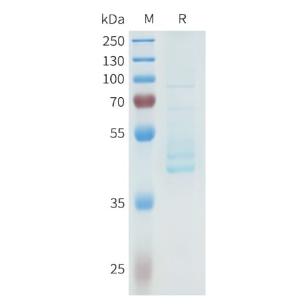 SDS-PAGE - Recombinant Human P-Cadherin Protein (C-terminal hFc Tag) (A332965) - Antibodies.com