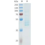 SDS-PAGE - Recombinant Human P-Cadherin Protein (C-terminal hFc Tag) (A332965) - Antibodies.com