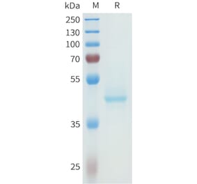 SDS-PAGE - Recombinant Human P-Cadherin Protein (C-terminal hFc Tag) (A332966) - Antibodies.com
