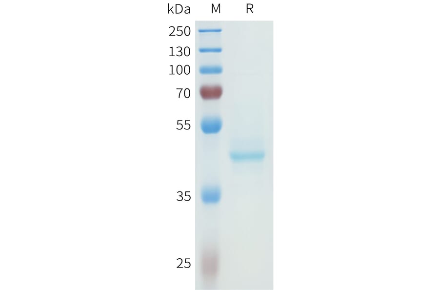 SDS-PAGE - Recombinant Human P-Cadherin Protein (C-terminal hFc Tag) (A332966) - Antibodies.com