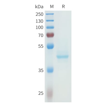 SDS-PAGE - Recombinant Human P-Cadherin Protein (C-terminal hFc Tag) (A332966) - Antibodies.com