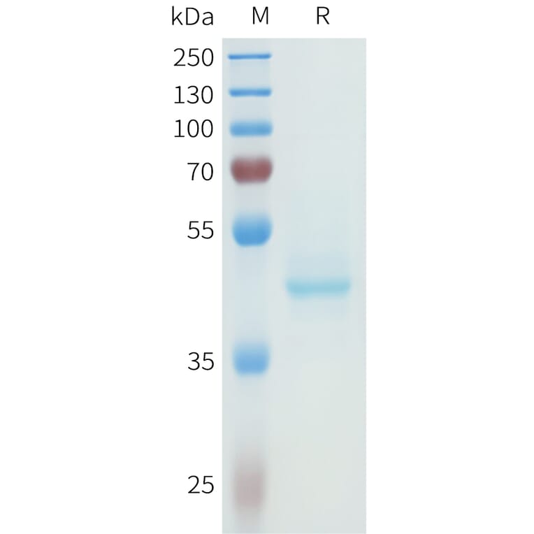 SDS-PAGE - Recombinant Human P-Cadherin Protein (C-terminal hFc Tag) (A332966) - Antibodies.com