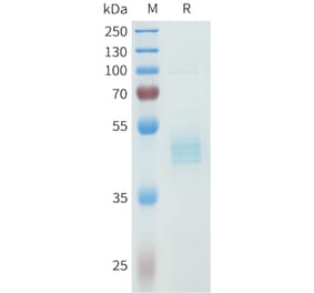 SDS-PAGE - Recombinant Human P-Cadherin Protein (C-terminal hFc Tag) (A332967) - Antibodies.com