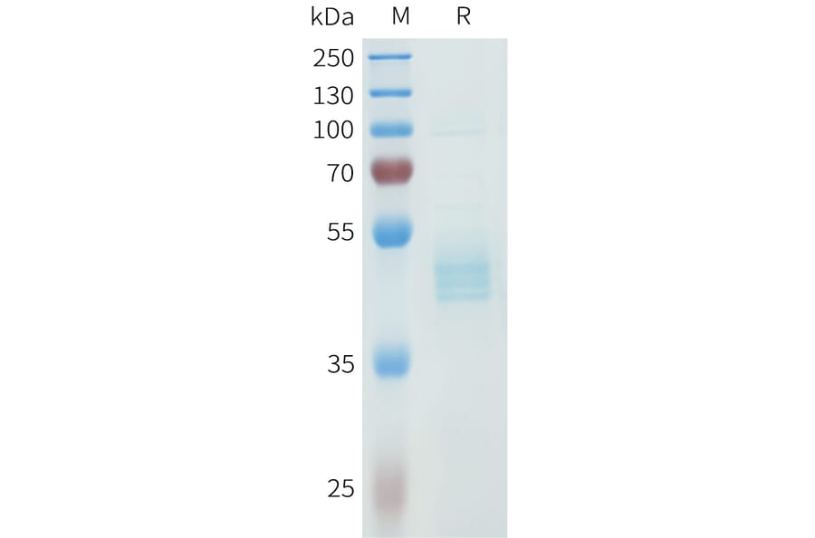 SDS-PAGE - Recombinant Human P-Cadherin Protein (C-terminal hFc Tag) (A332967) - Antibodies.com