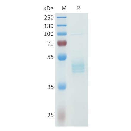 SDS-PAGE - Recombinant Human P-Cadherin Protein (C-terminal hFc Tag) (A332967) - Antibodies.com