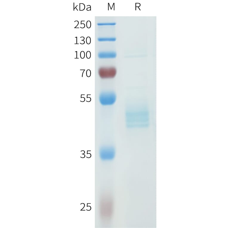 SDS-PAGE - Recombinant Human P-Cadherin Protein (C-terminal hFc Tag) (A332967) - Antibodies.com