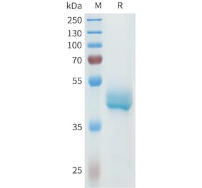 SDS-PAGE - Recombinant Human P-Cadherin Protein (C-terminal hFc Tag) (A332968) - Antibodies.com