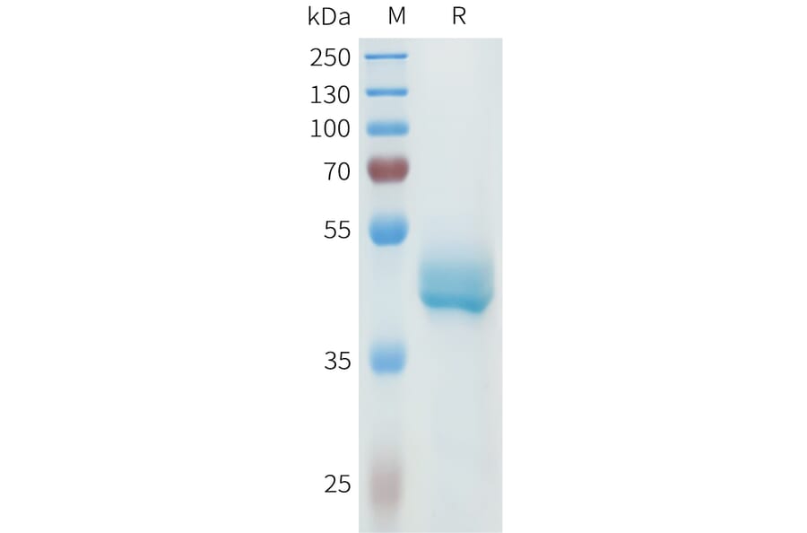 SDS-PAGE - Recombinant Human P-Cadherin Protein (C-terminal hFc Tag) (A332968) - Antibodies.com