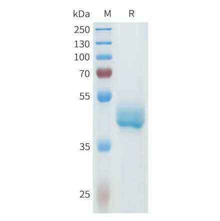 SDS-PAGE - Recombinant Human P-Cadherin Protein (C-terminal hFc Tag) (A332968) - Antibodies.com