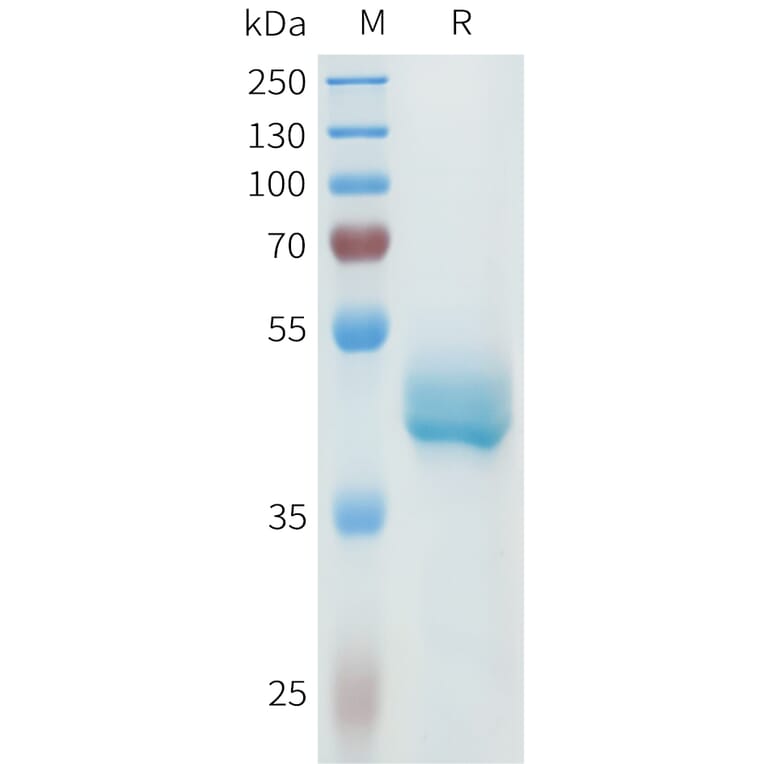 SDS-PAGE - Recombinant Human P-Cadherin Protein (C-terminal hFc Tag) (A332968) - Antibodies.com