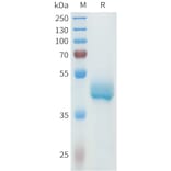 SDS-PAGE - Recombinant Human P-Cadherin Protein (C-terminal hFc Tag) (A332968) - Antibodies.com