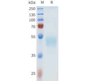 SDS-PAGE - Recombinant Human HHLA2 Protein (C-terminal hFc Tag) (A332969) - Antibodies.com