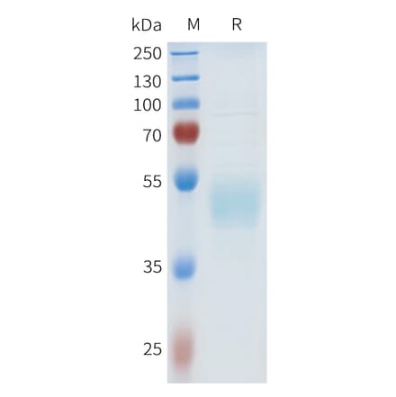 SDS-PAGE - Recombinant Human HHLA2 Protein (C-terminal hFc Tag) (A332969) - Antibodies.com
