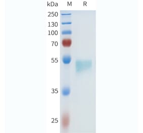 SDS-PAGE - Recombinant Human HHLA2 Protein (C-terminal hFc Tag) (A332970) - Antibodies.com