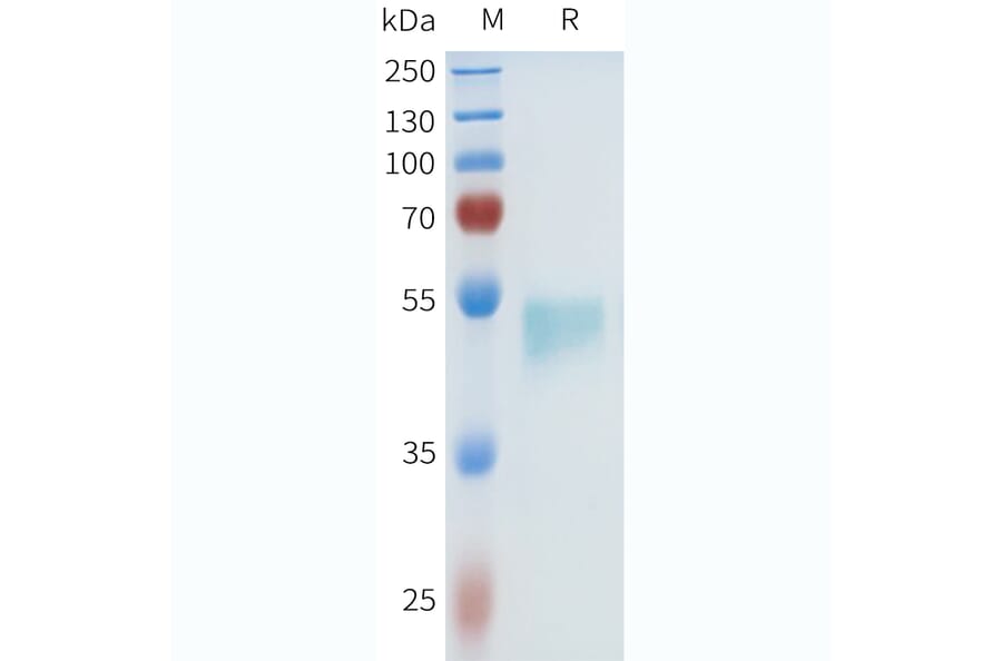 SDS-PAGE - Recombinant Human HHLA2 Protein (C-terminal hFc Tag) (A332970) - Antibodies.com