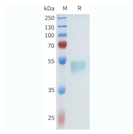 SDS-PAGE - Recombinant Human HHLA2 Protein (C-terminal hFc Tag) (A332970) - Antibodies.com