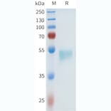 SDS-PAGE - Recombinant Human HHLA2 Protein (C-terminal hFc Tag) (A332970) - Antibodies.com